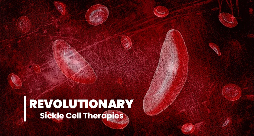 A Landmark in Medical Advancement: The Arrival of Revolutionary Sickle Cell Therapies